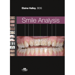 Smile Analysis - Elaine Halley - Dentistry Book - Book Cover