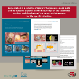 Adhesive cementation on natural teeth - Giacomo Derchi, Umberto Campaner - Dentistry Book - Book Extract