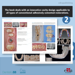 Dental Solutions - Adhesive Restoration - Marco Veneziani - Dental Restoration Techniques - Banner