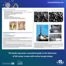 Fixed prosthesis with vertical margin closure - Book Details - Dentistry Book