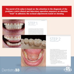 3STEP Additive Prosthodontics - DEntistry book - cover book - Francesco Vailati