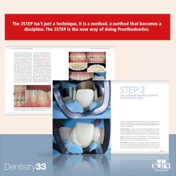 3STEP Additive Prosthodontics - Francesca Vailati - Urs Belser - Dentistry Book - Prosthodontics