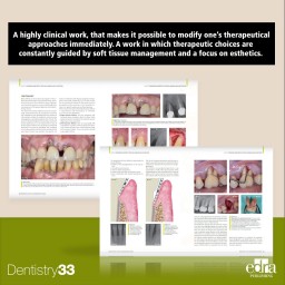 Periodontal Plastic And Regenerative Surgery - Cover Book - Daniele Cardaropoli -  Dentistry Book - Dental Surgery