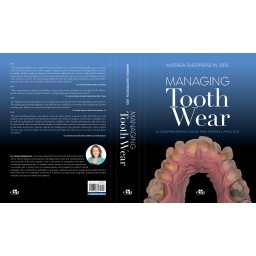 Managing Tooth Wear. A Comprehensive Guide for General Practice - Dentistry Book - 9781957260334