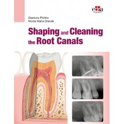 Shaping and Cleaning the Root Canals - Dentistry Book - 9781957260242 - Book Cover - Dentistry