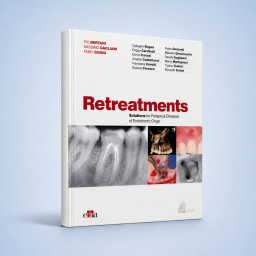 Retreatment. Solutions for apical diseases of endodontic origin - Book Details - Dentistry Book - 9788821450938