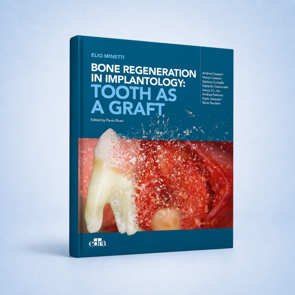 Bone regeneration in implantology: tooth as a graft - Dentistry book - cover book - Flavio Pisani - Elio Minetti