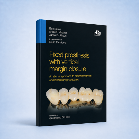 ENCYCLOPAEDIA of OCCLUSION【裁断済】 Fixed prosthesis with vertical margin closure. A rational approach