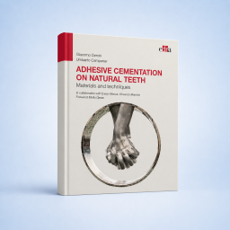 Adhesive cementation on natural teeth - Giacomo Derchi, Umberto Campaner - Dentistry Book - Book Cover