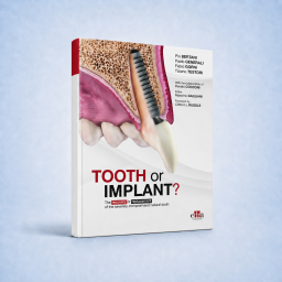 Tooth or Implant. The recovery or replacement of the severely compromised natural tooth - 9781957260525
