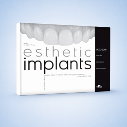Esthetic Implants - book details - dentistry book - Guido Picciocchi -Mario Gisotti - Diego Lops