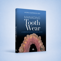 Managing Tooth Wear. A Comprehensive Guide for General Practice - 9781957260334