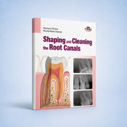 Shaping and Cleaning the Root Canals - Dentistry Book - 9781957260242 - Book Cover - Dentistry