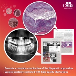 Microsurgical Endodontics - Book Cover - Dentistry book - 9788821448188 - Arnaldo Castellucci