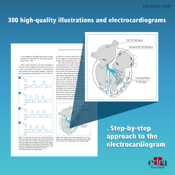 Electrocardiography of the dog and cat. Diagnosis of arrhythmias. II Edition - book cover - veterinary book