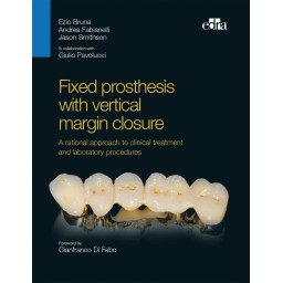 Fixed prosthesis with vertical margin closure - Book Cover - Dentistry Book